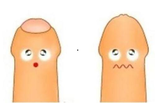 成人包茎如何处理方法视频,轻松解决私密困扰